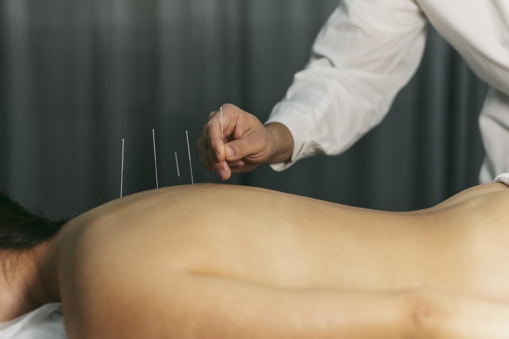 Acupuncturist in ridderkerk